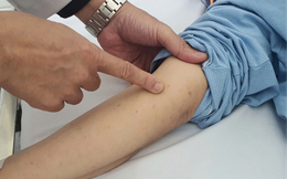 Gần 40.000 mũi vaccine não mô cầu được tiêm trên toàn quốc trong 4 ngày