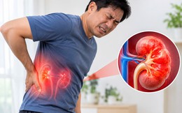 Chuyên gia chỉ: 5 DẤU HIỆU ở lưng có thể cảnh báo bệnh thận, nhiều người nghĩ chỉ là đau nhức thông thường