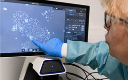 Sau 15 năm, các nhà khoa học đã tìm ra thuốc mới cho điều trị bệnh ung thư tuyến tụy