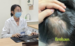 Một cái ôm với thú cưng, một mảng tóc không bao giờ mọc lại: Điều mọi ông bố có con nhỏ cần biết!