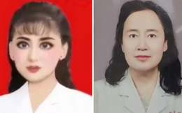 Bác sĩ tâm thần hoá celeb triệu view vì lỡ tay chỉnh ảnh quá đà, bệnh nhân tranh nhau đến khám