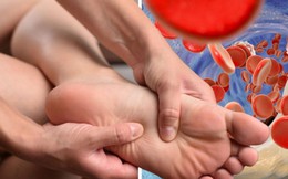 5 dấu hiệu cảnh báo acid uric đang cao vượt ngưỡng: Có 1 cũng cần cẩn thận kẻo gout sớm "gõ cửa"