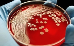 Siêu vi khuẩn mới sẽ còn đáng sợ hơn ung thư vì cứ 3 giây lại giết chết 1 người