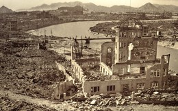 Câu chuyện về nỗi đau đớn kéo dài 7 thập kỷ của nạn nhân vụ đánh bom Hiroshima