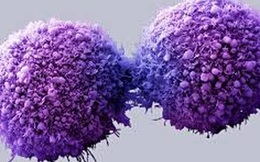 Kiêng đường để diệt ung thư: Ung thư chết hay người bệnh chết?