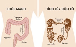 TS. Nguyễn Khánh Hòa phủ nhận detox, cảnh báo rất nhiều tác hại