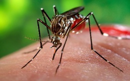 Virus Zika có thể gây rối loạn thần kinh nghiêm trọng