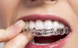 Dùng kem đánh răng hàng ngày mà răng vẫn vàng ố, nghe nha sĩ Mỹ chia sẻ 3 cách làm trắng răng tức thì