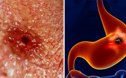 Sau khi biết những thông tin này, bạn sẽ bỏ ngay thói quen uống cà phê khi đói bụng