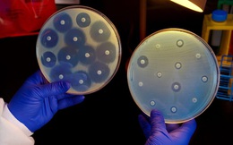Nhóm vi khuẩn kháng kháng sinh khiến một phụ nữ Mỹ thiệt mạng tuần trước đang âm thầm lây lan