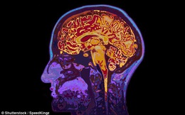 Quét não của những người mất một tay bẩm sinh, các nhà khoa học nghi ngờ bấy lâu nay mình đã hiểu sai về não bộ