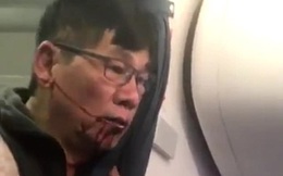 Cổ phiếu United Airlines "hồi sinh” sau bê bối đẩy khách gốc Việt khỏi máy bay