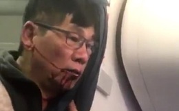 United Airlines đạt thỏa thuận đền bù với bác sĩ gốc Việt, giấu số tiền bồi thường