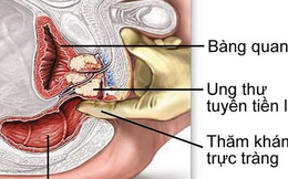 Căn bệnh này là nguyên nhân dẫn đến vô sinh: 7 lời chuyên gia khuyên để phòng bệnh