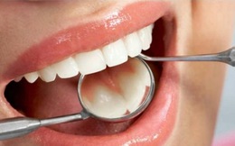 Có vắc xin ngừa sâu răng, cần đánh răng nữa không?