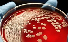Siêu vi khuẩn kháng thuốc xuất hiện nhiều ở bệnh viện là loại nào?