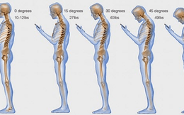 Nhìn vào bức tranh này sẽ thấy: Dùng điện thoại nhiều sẽ làm hỏng xương sống như thế nào?