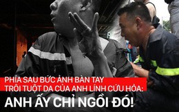 Nữ phóng viên chụp bức ảnh anh lính cứu hỏa bị bỏng tuột da tay: "Anh ấy chỉ ngồi đó, mắt vẫn hướng về đồng đội và đám cháy"