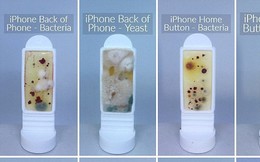 Hình ảnh kinh hoàng về độ bẩn của những chiếc điện thoại: Nhiều vi khuẩn gấp 10 lần bồn cầu