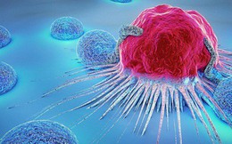 5 thói quen "nuôi lớn" tế bào ung thư: Nguy cơ mắc bệnh cao nếu bạn không chịu thay đổi