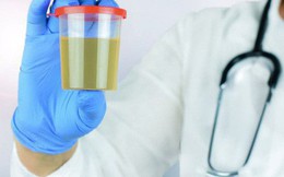10 bí mật về nước tiểu liên quan đến thận, sức khỏe: Ai cũng nên biết rõ để phòng bệnh tốt