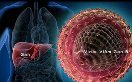 “Kẻ giết người thầm lặng” này được coi nguy hiểm hơn cả HIV, cứ 10 người Việt lại có 1 người bị mắc bệnh