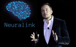 Dự án tham vọng cấy chip vào não người của "phù thủy" Elon Musk vừa nhận đầu tư 100 triệu USD