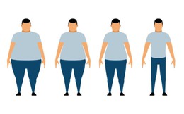 Hiểu về phẫu thuật giảm béo: phương pháp cứu cánh cho những người thừa cân quá độ