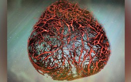 Lần đầu tiên nuôi thành công mạch máu người: cuộc cách mạng lớn với hàng triệu người đã xuất hiện