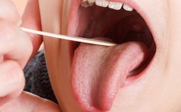 Nếu bạn hay bị cắn vào lưỡi khi ăn: Đừng bỏ qua 3 yếu tố này, có thể là bệnh nguy hiểm