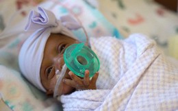 Bé gái nhỏ nhất thế giới được sinh ra ở Mỹ, nặng 245 gam, nhỏ chỉ bằng hộp sữa