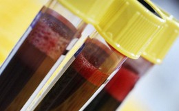 Xét nghiệm máu có thể dự đoán trước cái chết, độ chính xác tới 83%