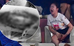 Bác sĩ Bệnh viện Xanh Pôn thông tin vụ nữ CĐV bị pháo bắn trúng: Vết thương do công phá từ sức nổ, không phải do bỏng