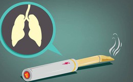 Thuốc lá điện tử không hề an toàn: Đã có bằng chứng cho thấy nó gây ung thư phổi