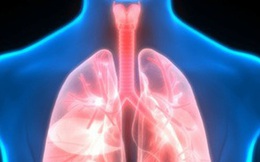 Ô nhiễm không khí kéo dài, cần làm gì để phổi luôn sạch?