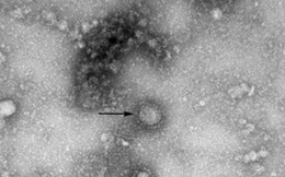 Xác nhận bệnh nhân Thái Lan đầu tiên bị nhiễm chủng virus corona mới