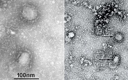 TQ công bố "chân dung" virus corona: Sự nguy hiểm chết người đằng sau tử thần nhỏ hơn cả bụi siêu mịn