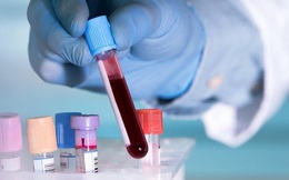 Nghiên cứu mới: Người có nhóm máu A dễ mắc Covid-19