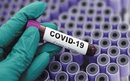 Covid-19 không giống với cúm mùa, nó nguy hiểm gấp hàng chục lần