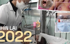 Năm 2022: Dịch bệnh và những loại virus gây bệnh phức tạp, nguy cơ tử vong tới 90% và chưa có vaccine phòng ngừa