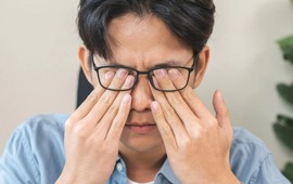 Choáng: Người đàn ông có hàng nghìn con rận ở mi mắt, bác sĩ chỉ ra nguyên nhân nhiều người mắc phải