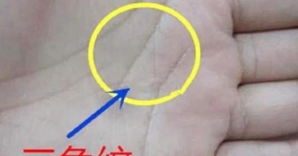 Điều gì giấu sau vân hình tam giác trên lòng bàn chân?
