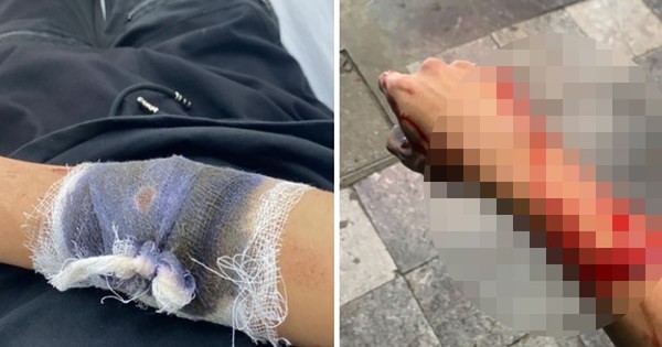 Công an Hà Nội truy lùng toán cướp gây án trước Nhà hát Lớn
