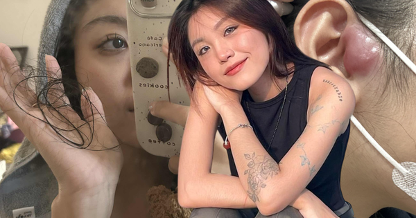 Cô gái TP.HCM 24 tuổi bị ung thư hạch giai đoạn 4: Bác sĩ nói lý do có thể đến từ... mọi thứ