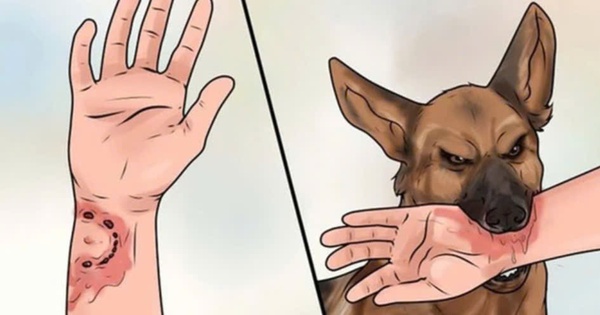 Trước khi chết, 1 con chó hoang đã cắn 3 người, Phan Thiết ra thông báo khẩn