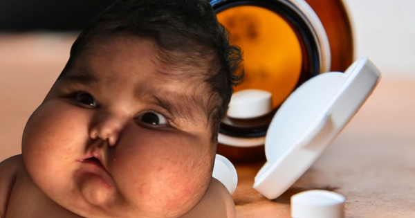 Ngày càng nhiều trẻ bị tác dụng phụ do dùng thuốc chứa corticoid: Dược sĩ chỉ rõ cách nhận biết corticoid trong đơn thuốc của con