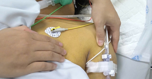 Toàn thân vàng như nghệ, suy đa tạng chỉ trong 24 giờ: Bác sĩ Hồi sức tích cực cảnh báo ‘tử thần’ mùa mưa