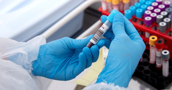 Đột phá y học: Xét nghiệm máu phát hiện UNG THƯ sớm đến 10 năm trước khi có triệu chứng