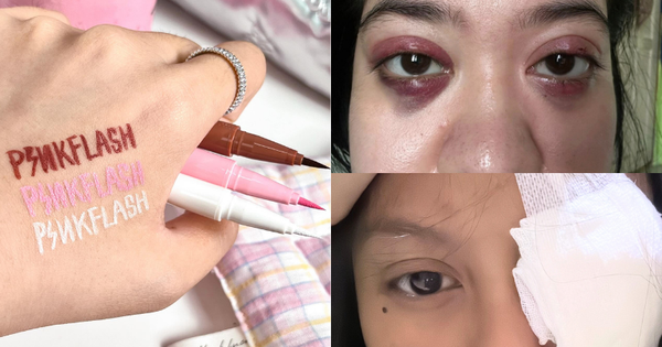 Phấn mắt PINKFLASH dính bê bối lớn: Người dùng bị lẹo mắt hàng loạt, hãng tiêu huỷ, đền tiền gấp đôi