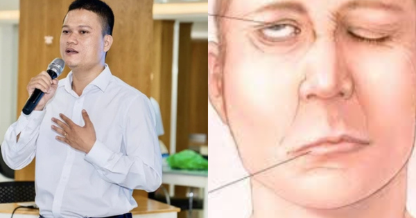 Nhà sáng lập thương hiệu Cà Mèn qua đời ở tuổi 34 vì đột quỵ: Căn bệnh tăng cao khi trời lạnh, có 4 dấu hiệu nhận biết sớm nhiều người bỏ qua